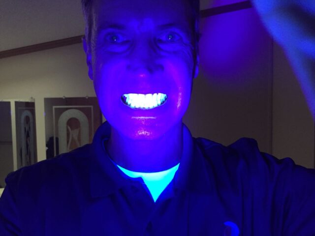 My teeth fluorescing under UV light