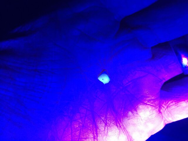 Tooth in my hand under UV Light