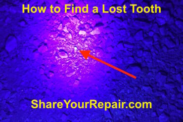 How to Find a Lost Tooth